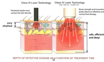 Class III Laser Technology